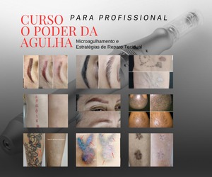 Curso de Microagulhamento para Reparo Tecidual - O Poder da agulha